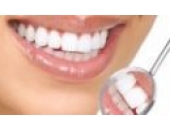 Chăm sóc sau cấy ghép Implant
