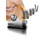 Các loại trụ Implant
